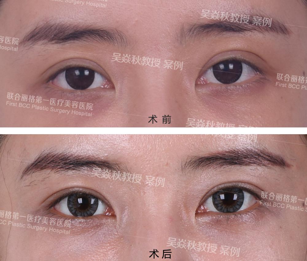 北京最有名的眼睛修复专家都有哪些？谁最好？