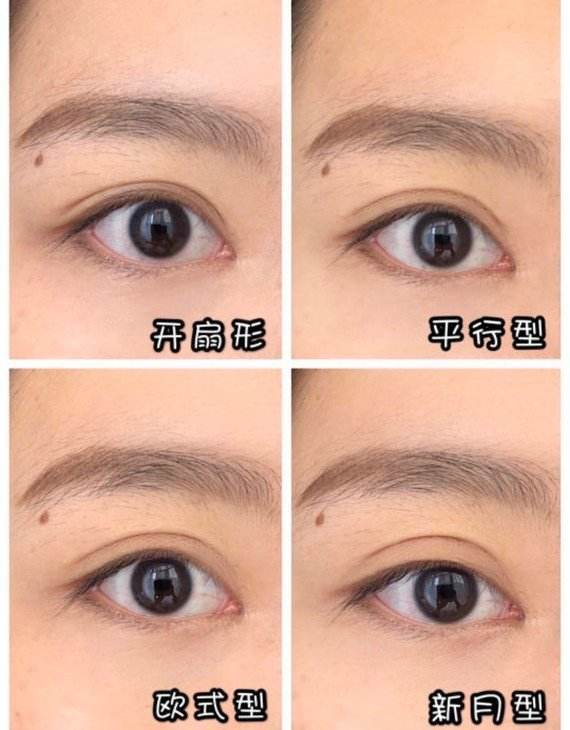 北京哪个医生双眼皮手术最好？