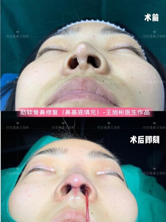 武汉鼻修复最好的医生是哪个？