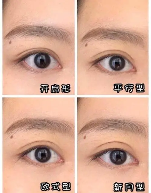 王太玲卢建建修复双眼皮谁的技术好？