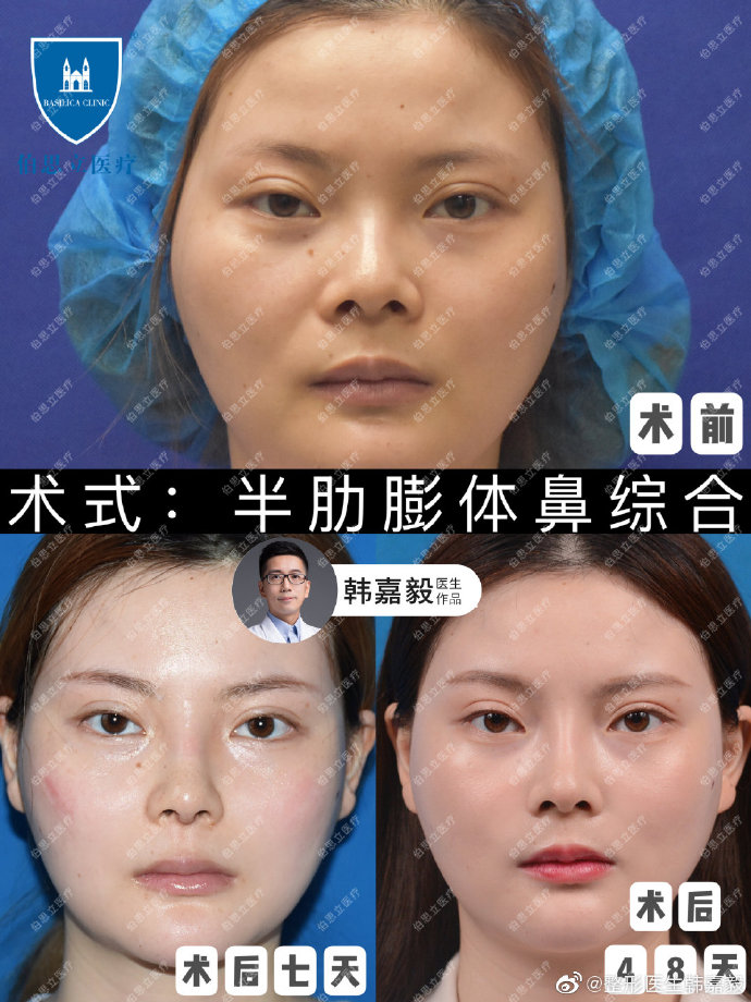 2022年上海做鼻子医生谁口碑最好?