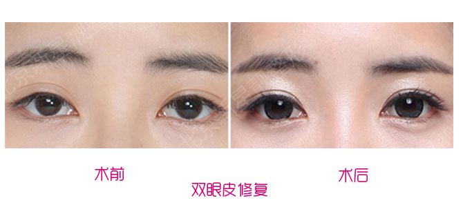 中国眼修复专家刘风卓和王振军哪个更厉害?