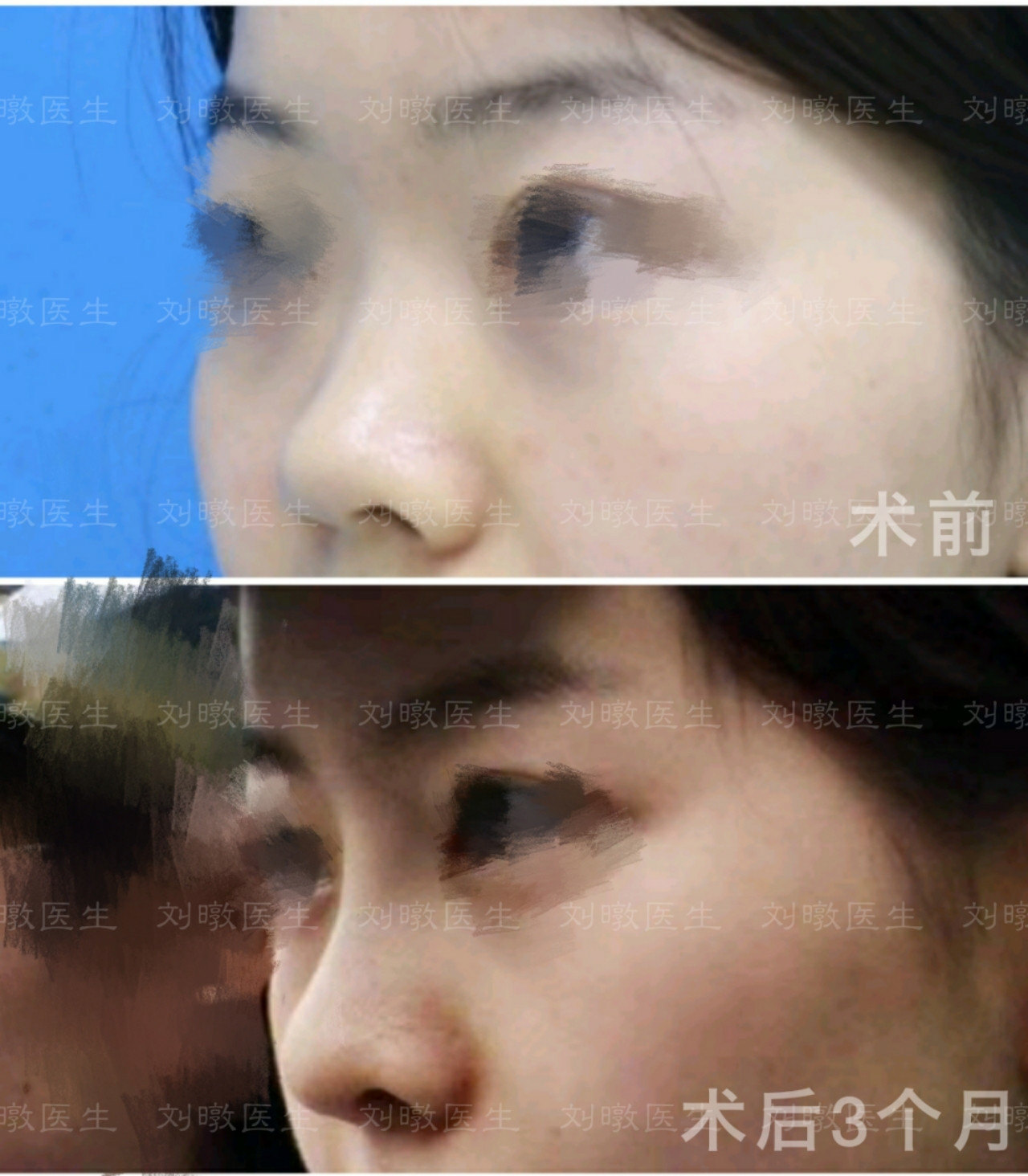 北京鼻综合好的三甲医院都有哪些 整形医生预约网 北京鼻综合好的三甲医院都有哪些 整形医生预约网