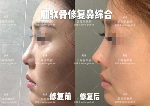 北京八大处鼻子整形修复专家有哪些？