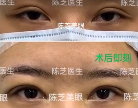 广州眼修复专家哪个最好？