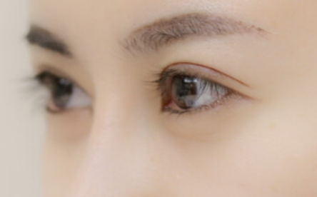 上海九院做双眼皮哪个专家最好？