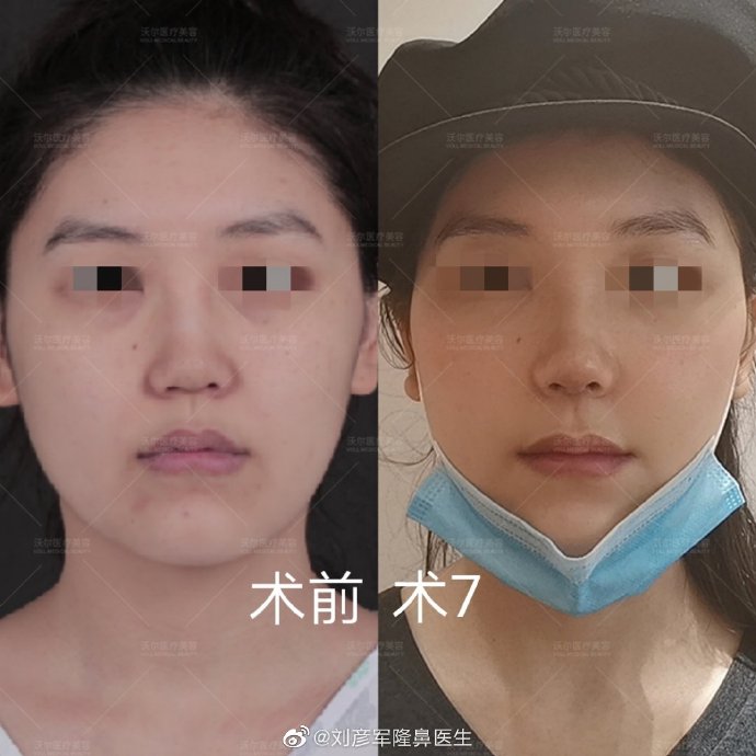 北京做鼻子修复的最好的医生有哪些？