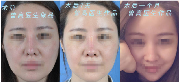 北京做鼻子修复的最好的医生有哪些？