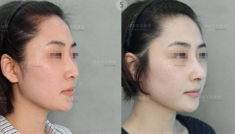 中国最好的鼻子修复整形医生排行榜