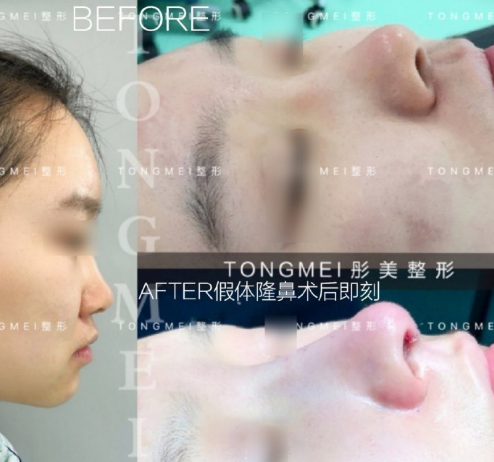 北京做鼻子做得好的医生有哪些？