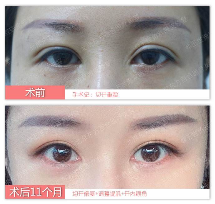 中国哪个医生眼睛修复得好？