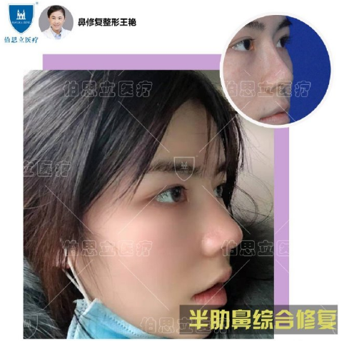 上海鼻部修复哪个医生最好？