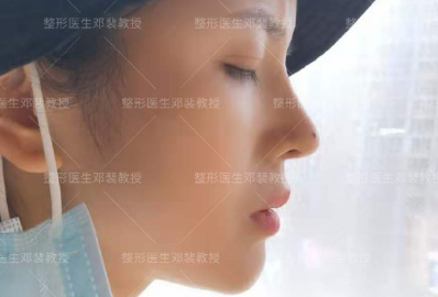 武汉李爱林和邓裴谁做鼻子好？邓裴李爱林隆鼻谁更好？