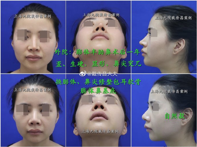上海九院整复外科鼻修复推荐医生有哪些？