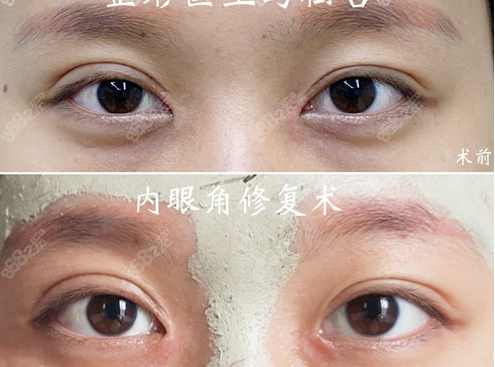 广州最擅长做眼部修复的专家预约排行榜前五名